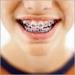 The Brace Place